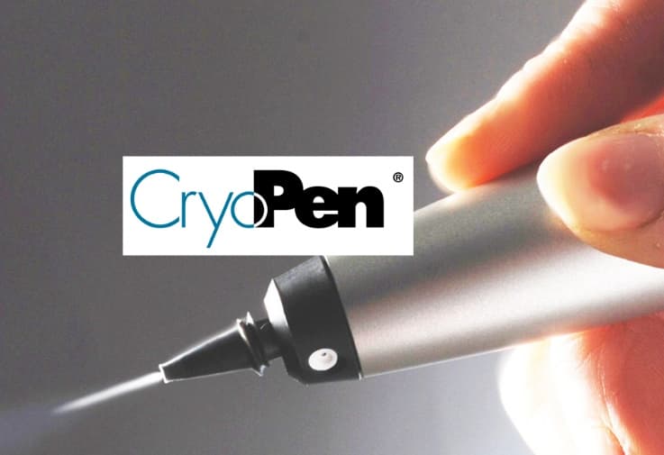 Cryotherapy Pen